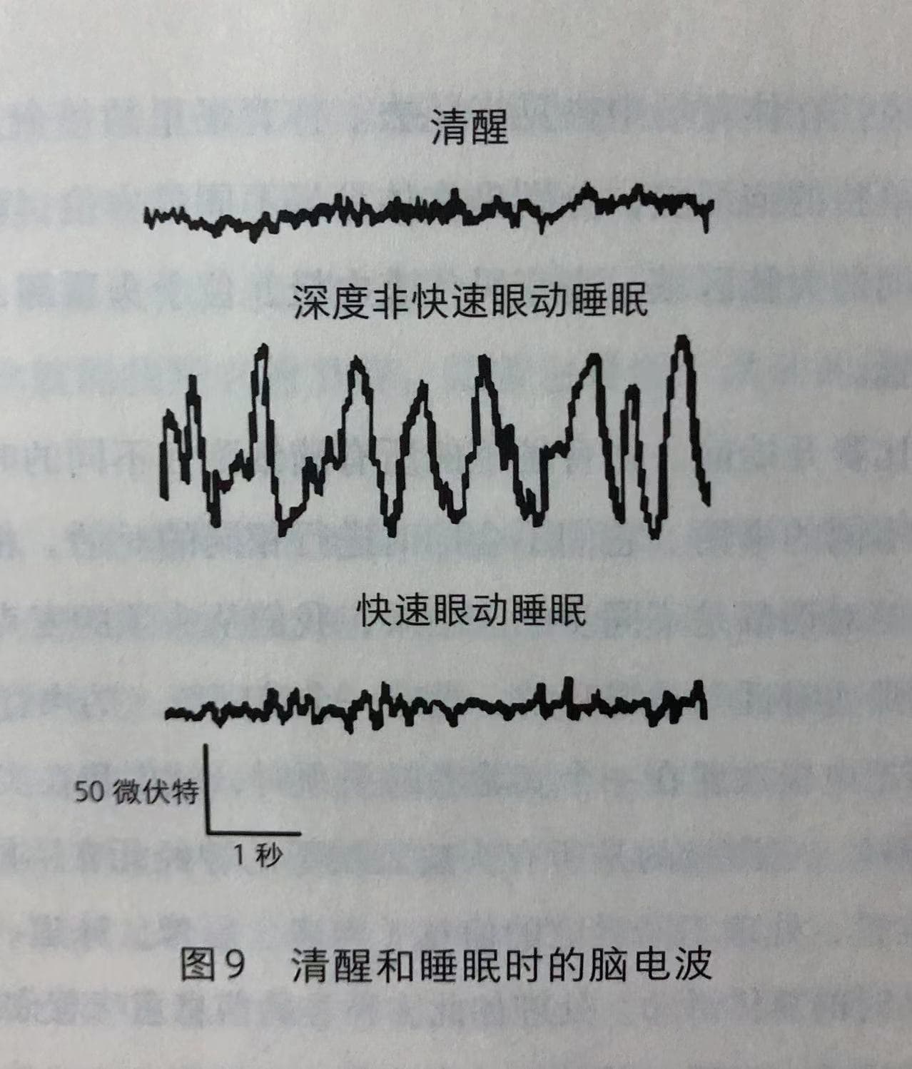 清醒和睡眠脑电波图