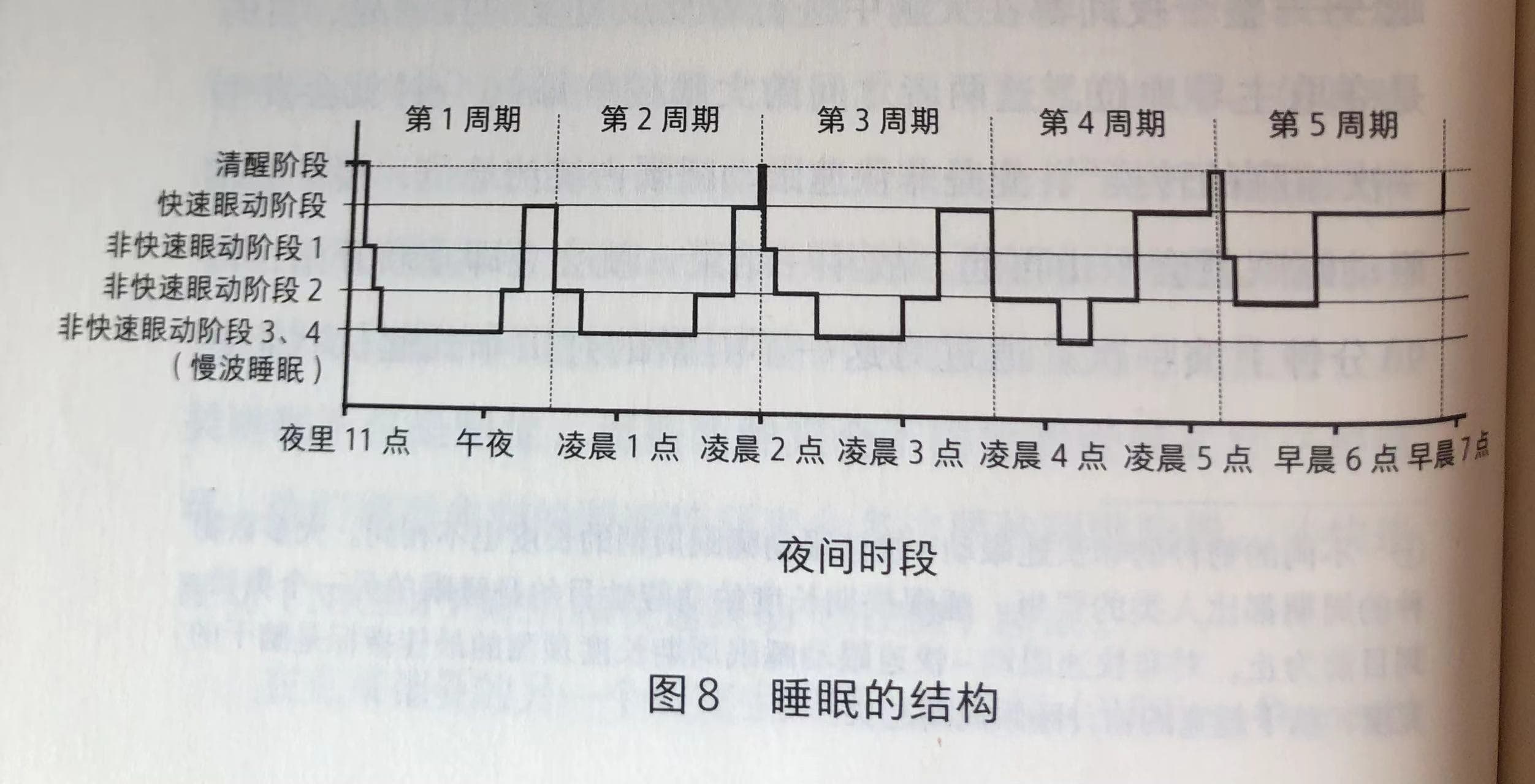 周期性睡眠结构图